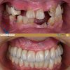 dental care in old age.jpg